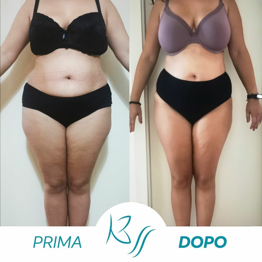Forza e Determinazione: Il Percorso Trasformativo di una Donna con il Kalyana Self System